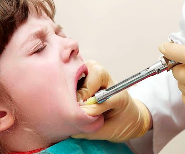 anestesia dental en niños